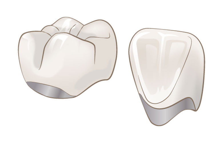 東京神楽坂歯科　審美治療