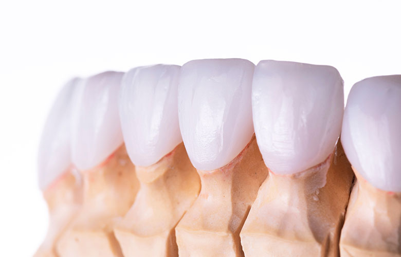 東京神楽坂歯科　噛み合わせ治療