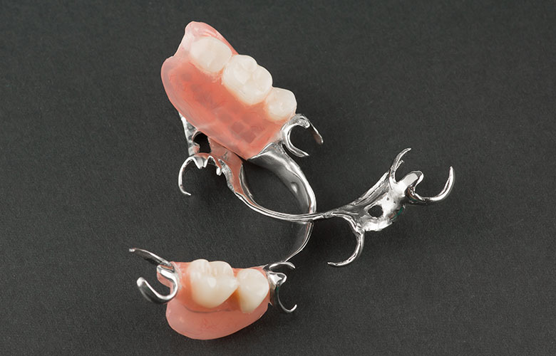 東京神楽坂歯科　入れ歯・義歯治療