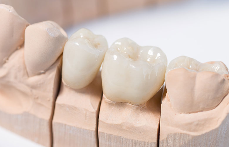 東京神楽坂歯科　一般歯科・虫歯治療