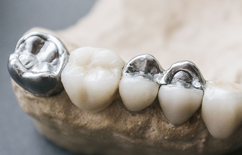 東京神楽坂歯科　一般歯科・虫歯治療