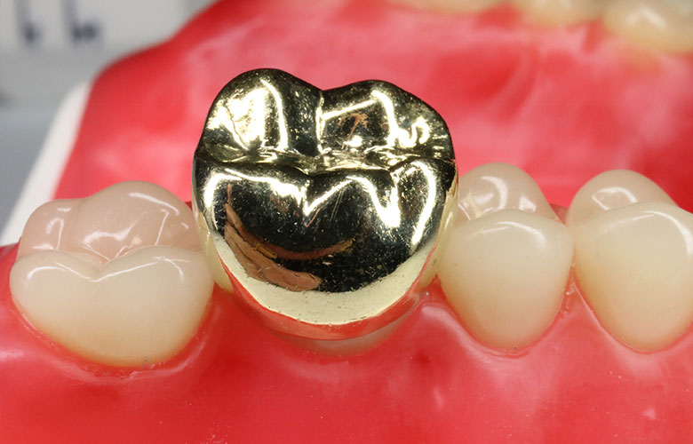 東京神楽坂歯科　一般歯科・虫歯治療