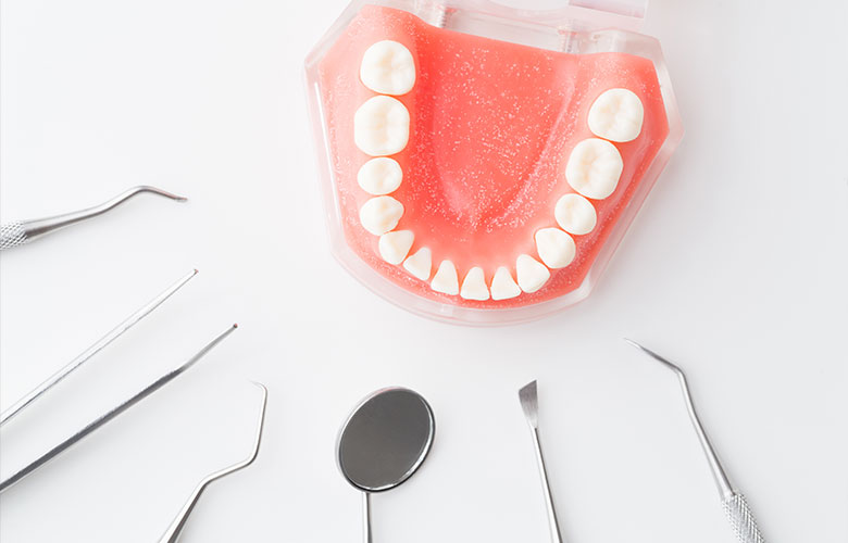 東京神楽坂歯科　インプラント治療