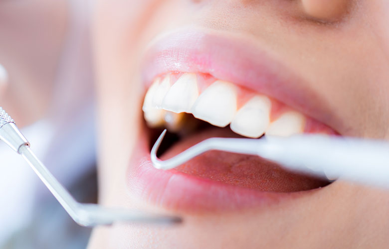 東京神楽坂歯科　予防歯科・PMTC