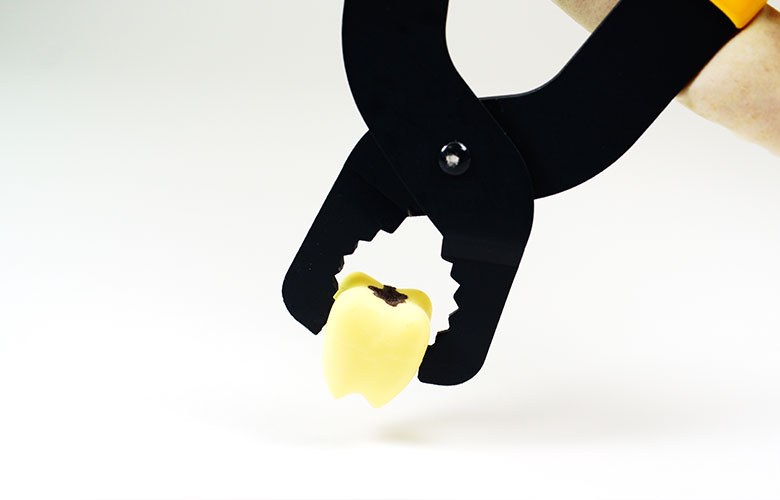 東京神楽坂歯科　意図的再植