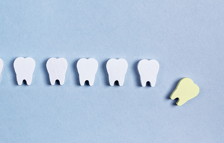 東京神楽坂歯科　自家歯牙移植