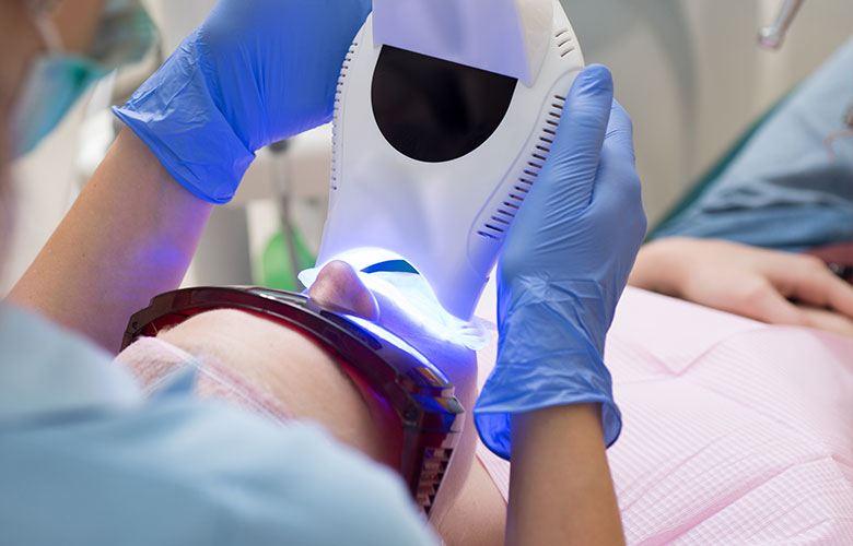 東京神楽坂歯科 ホワイトニング