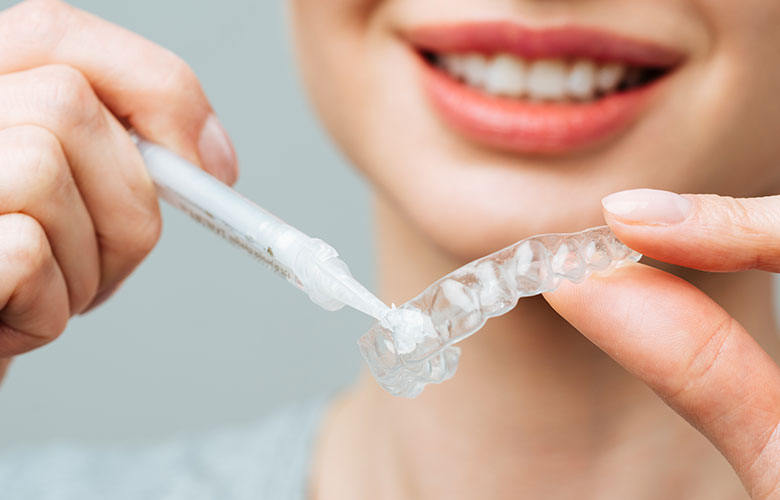 東京神楽坂歯科 ホワイトニング