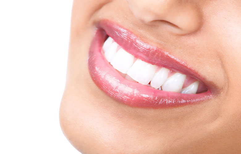 東京神楽坂歯科 ホワイトニング